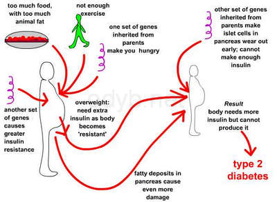 Does eating too much sugar cause diabetes?